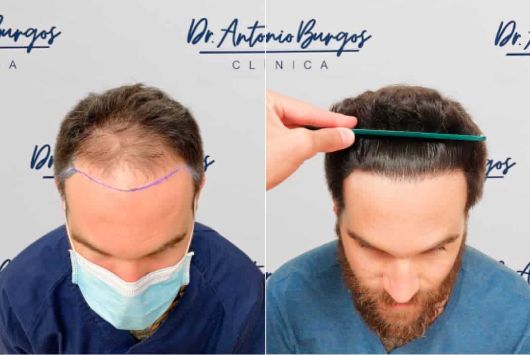 Rectangle 37 Clínica Burán
