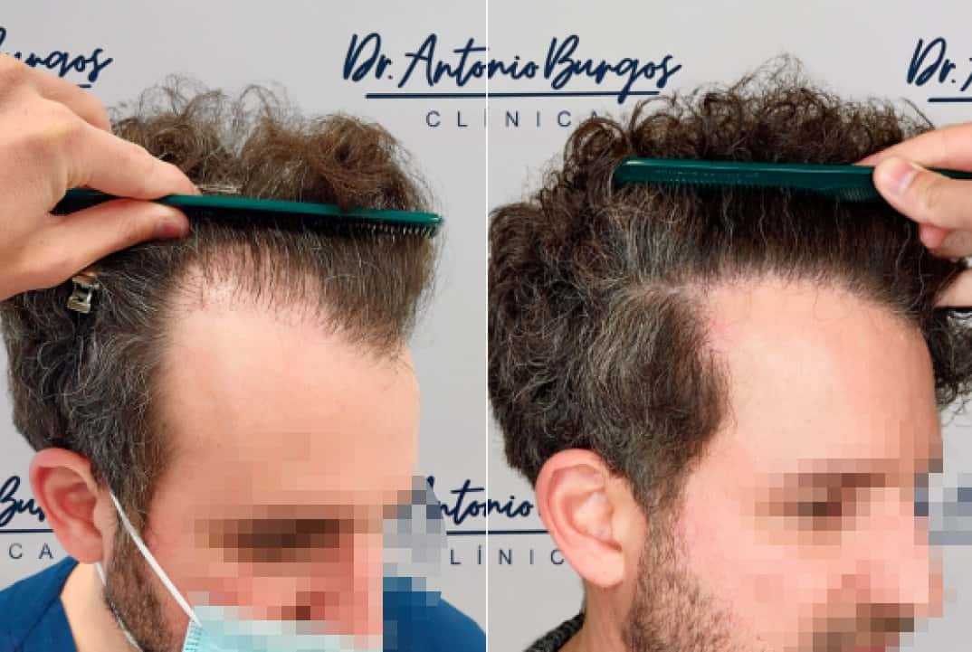 cliente 1 Clínica Burán