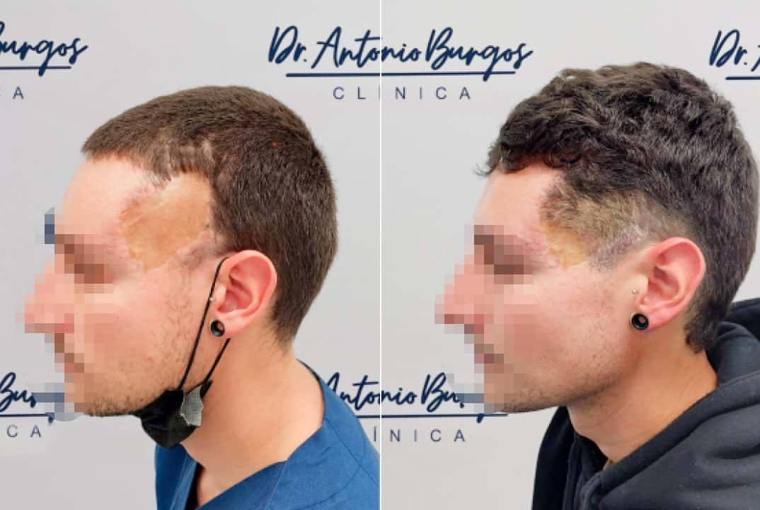 cliente 2 Clínica Burán