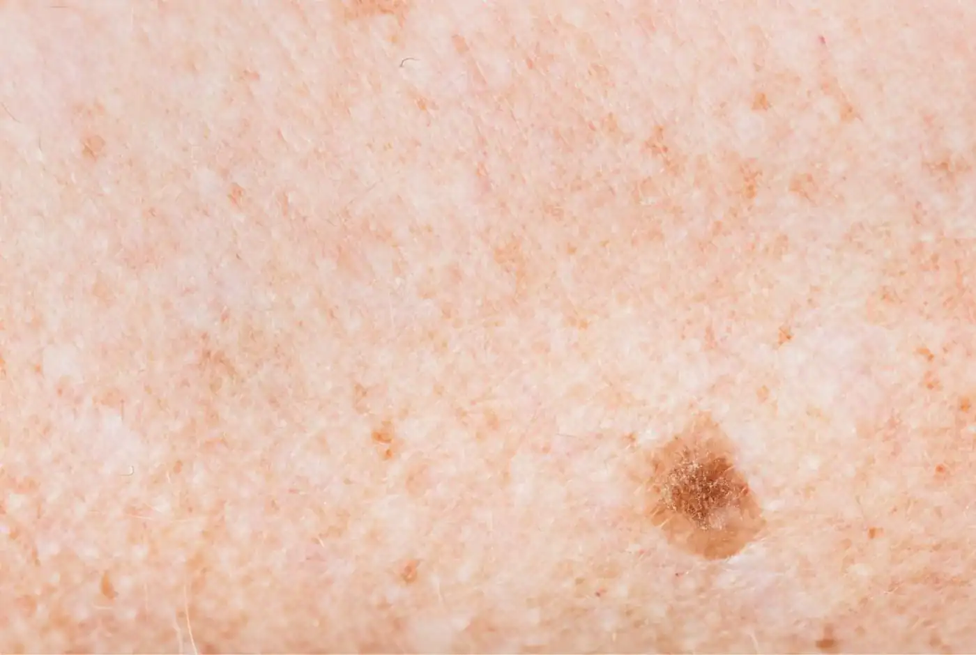 mejor dermatologo de malaga