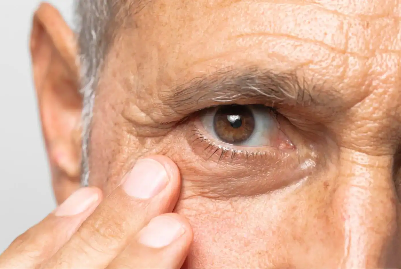 mejor clinica oculoplastia malaga