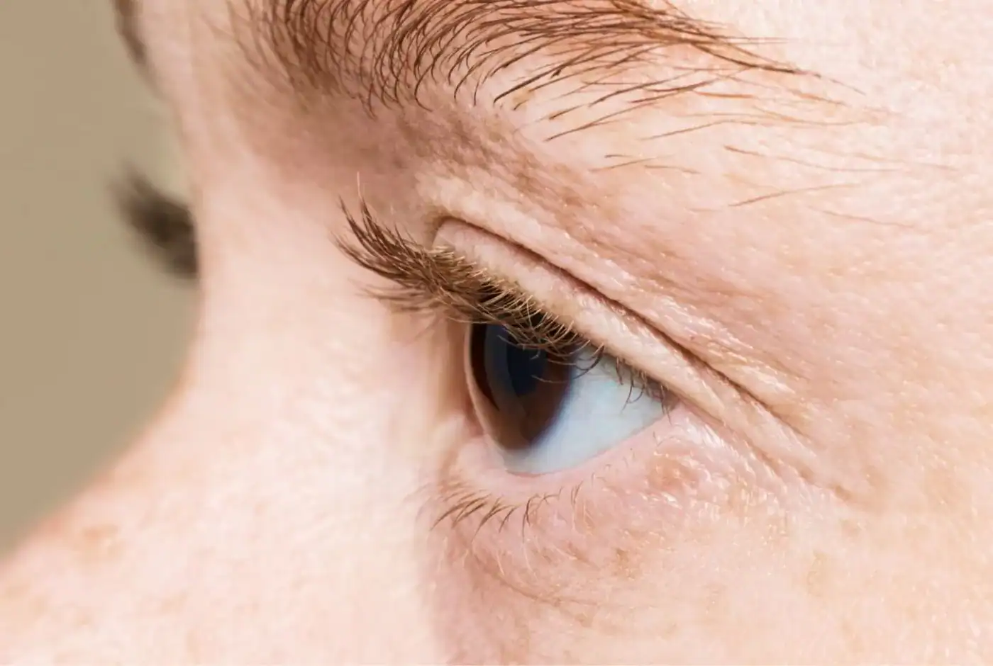 precio clinica oculoplastia