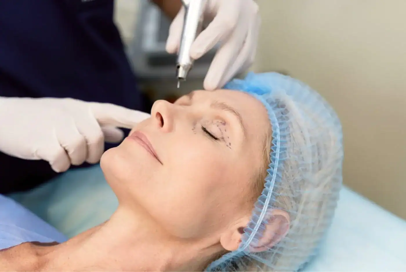 clinica oculoplastia malaga