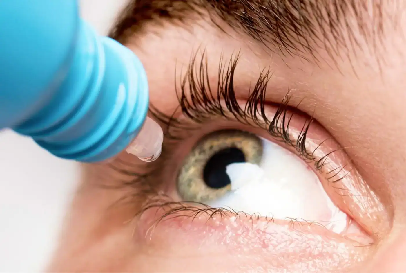 ptosis palpebral oculoplastia malaga Clínica Burán