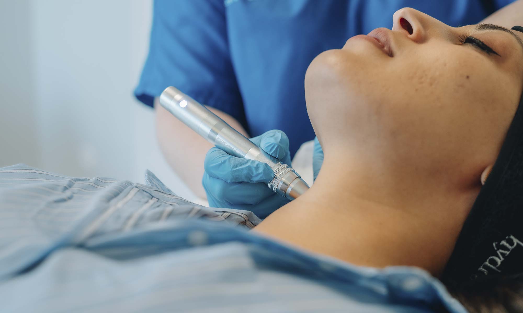 microneedling malaga precio