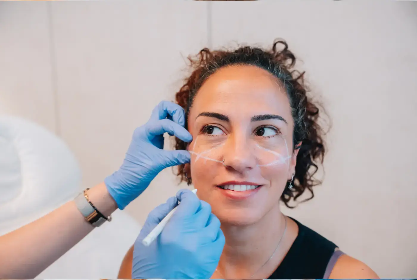 tratamiento estetico pomulos
