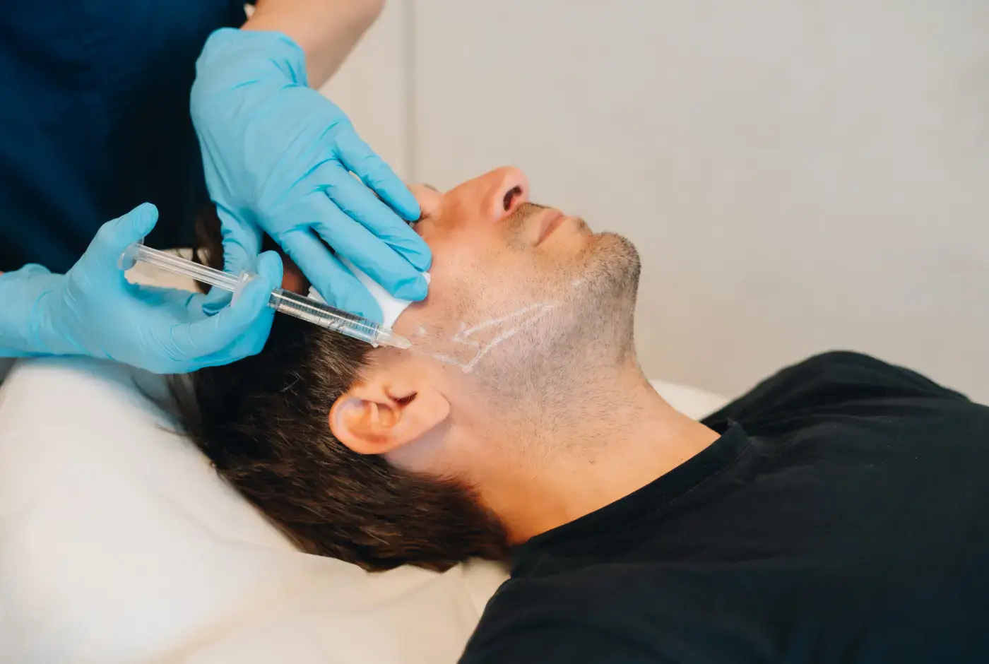 tratamiento marcacion mandibular medicina estetica Clínica Burán