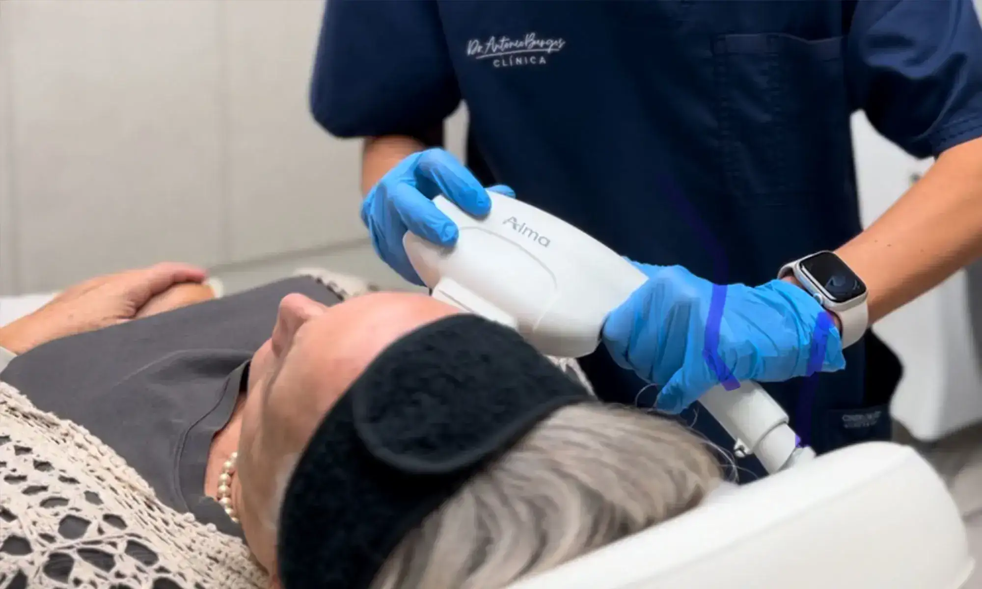 IPL luz pulsada malaga clinica dr antonio burgos Clínica Burán